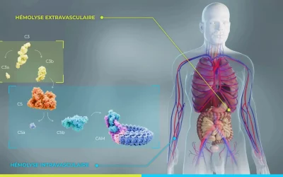 HPN : pourquoi les globules rouges sont détruits ? comprendre l’hémolyse intravasculaire (HIV) et extravasculaire (HEV)